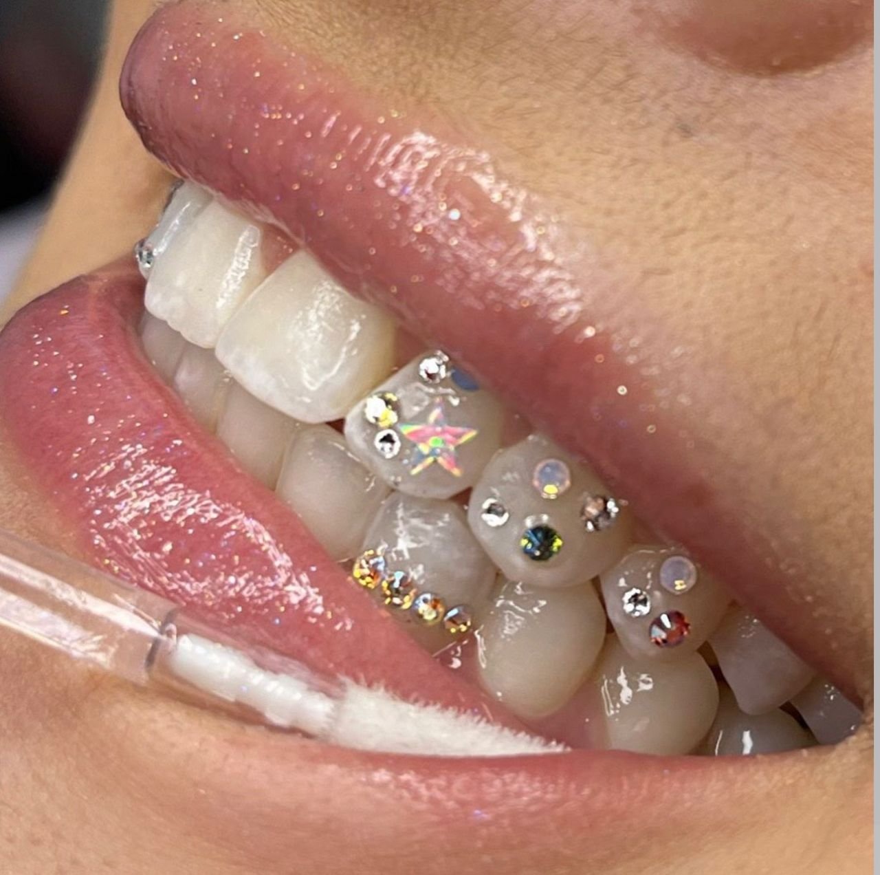 Medford Teeth Whitening and Jeweling